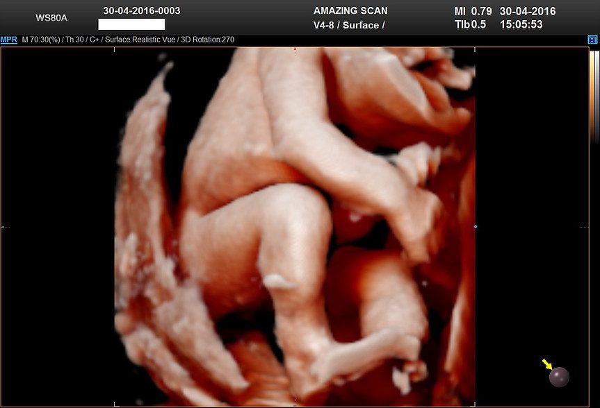 4D ultrasound.jpg